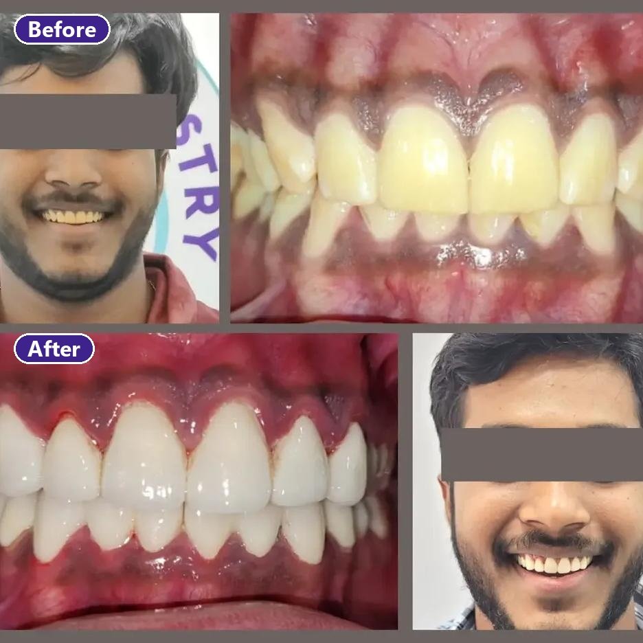 Complete Smile Reconstruction - slide 1