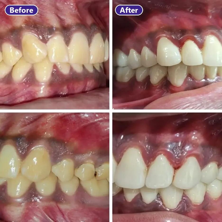 Complete Smile Reconstruction - slide 2