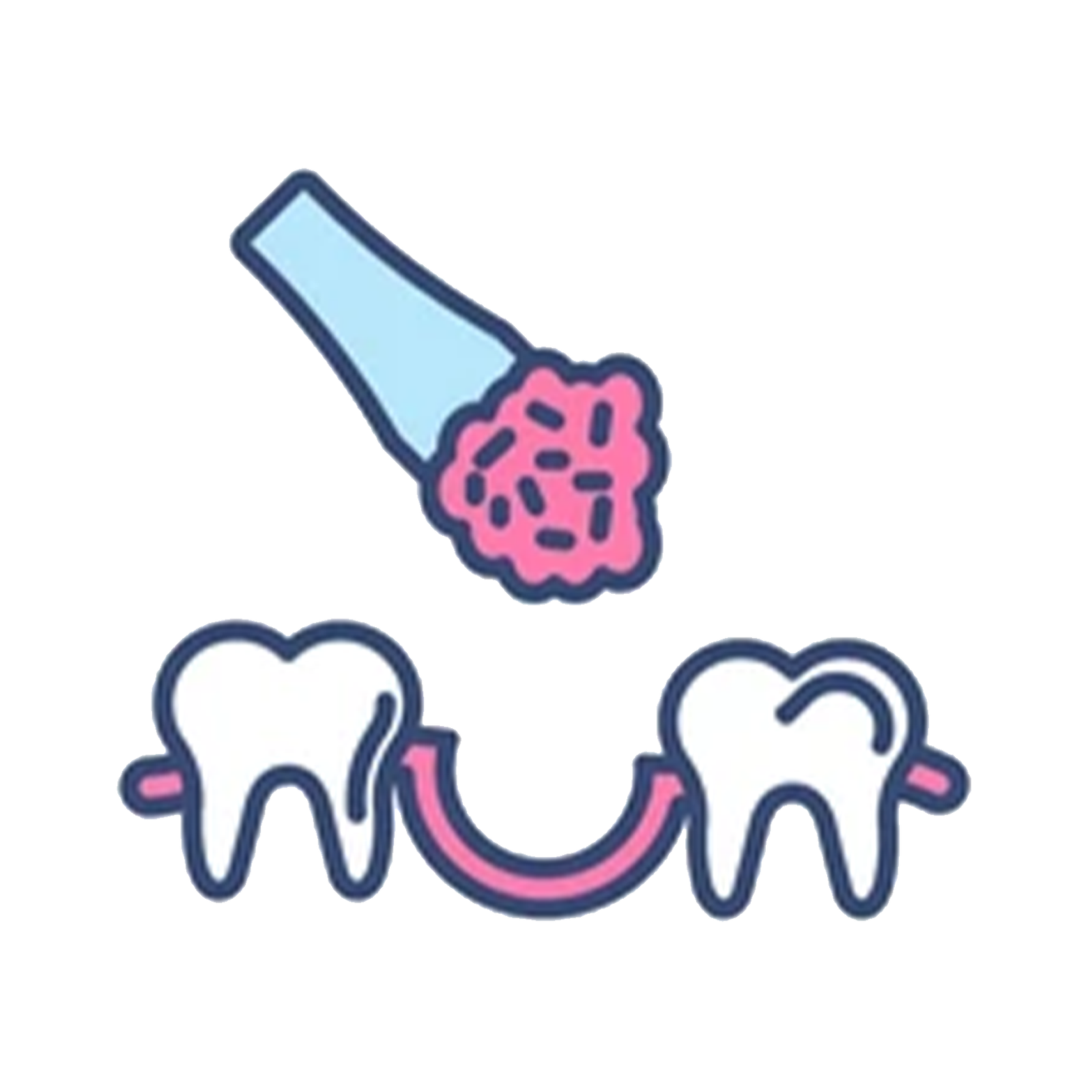 Socket Preservation Grafting