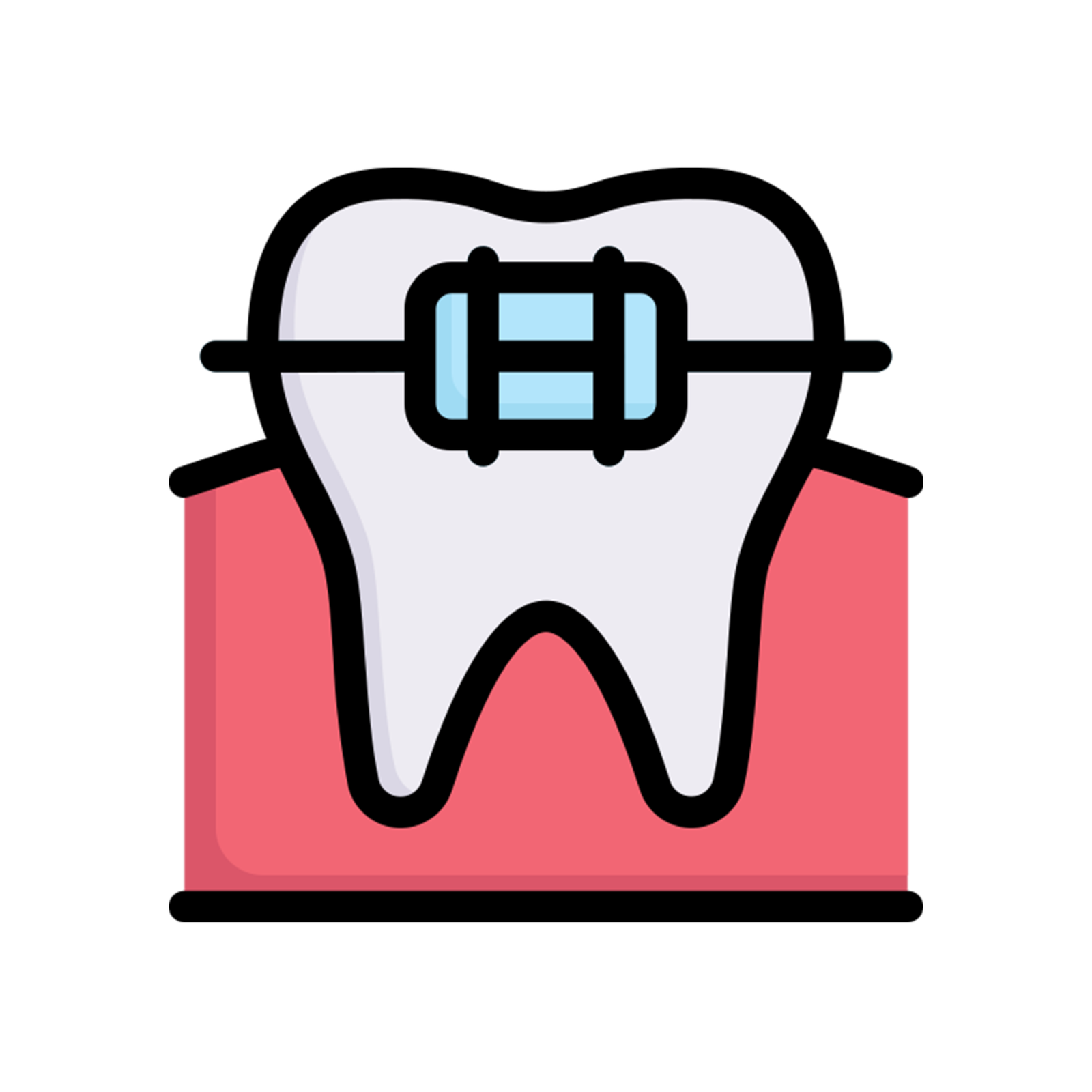 Ceramic Braces