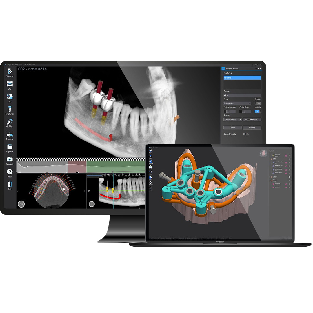 Digital Implant Planning Software