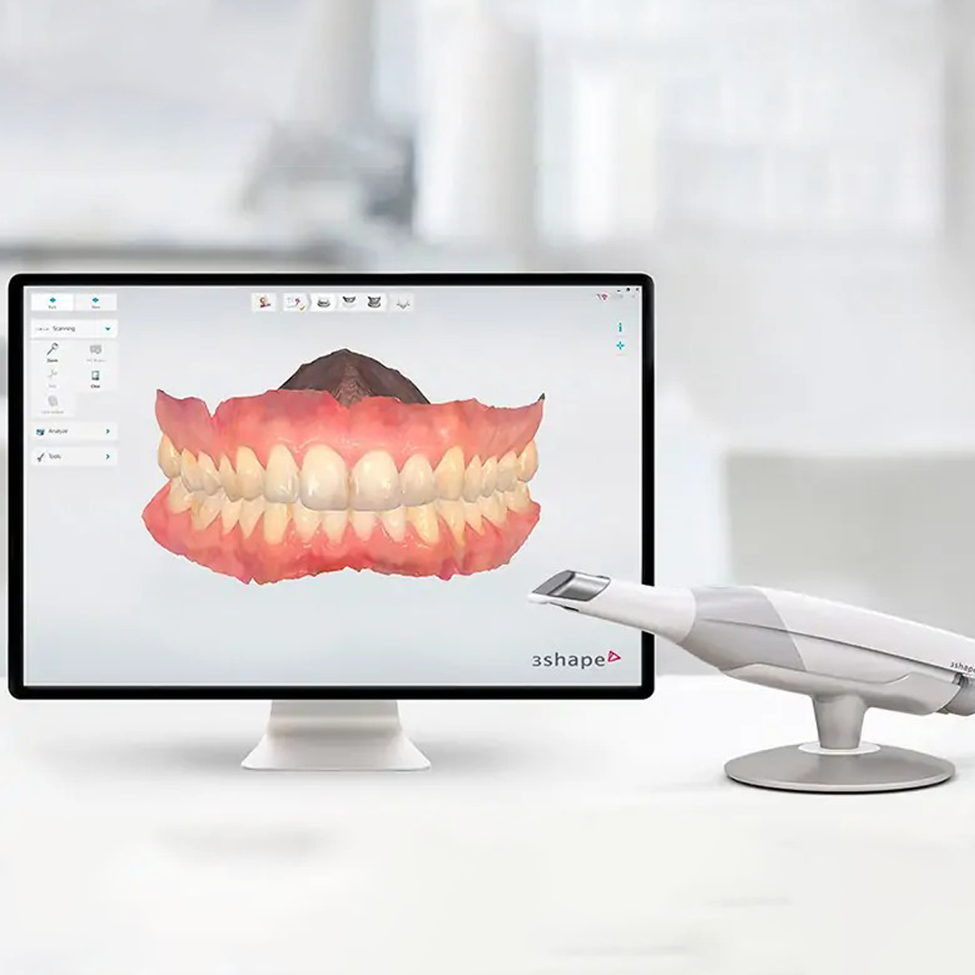 Intraoral Scanners